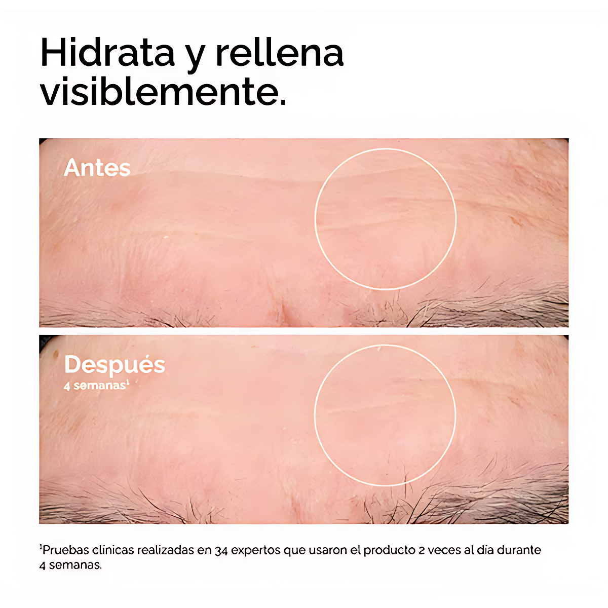 Hyaluronic Acid 2% + B5 – Hidratación Profunda y Piel Radiante